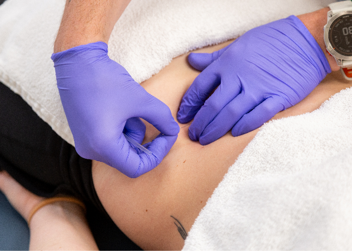 dry-needling-homepage-specialties-langford-sports-physical-therapy-albuqerque-nm