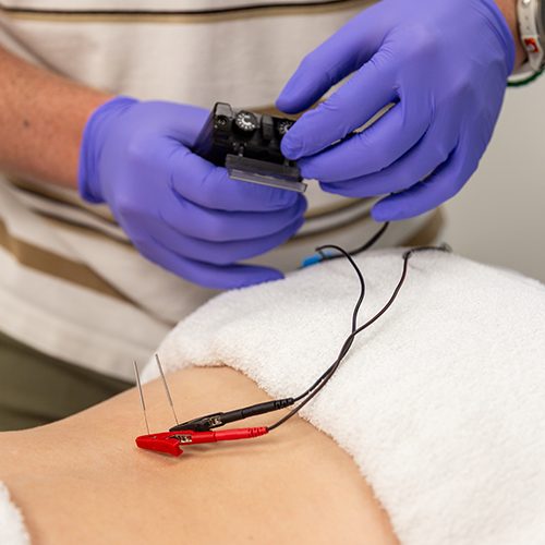 dry-needling-Langford-Sports-and-Physical-Therapy-Nob-Hill-North-Valley-Albuquerque-NM